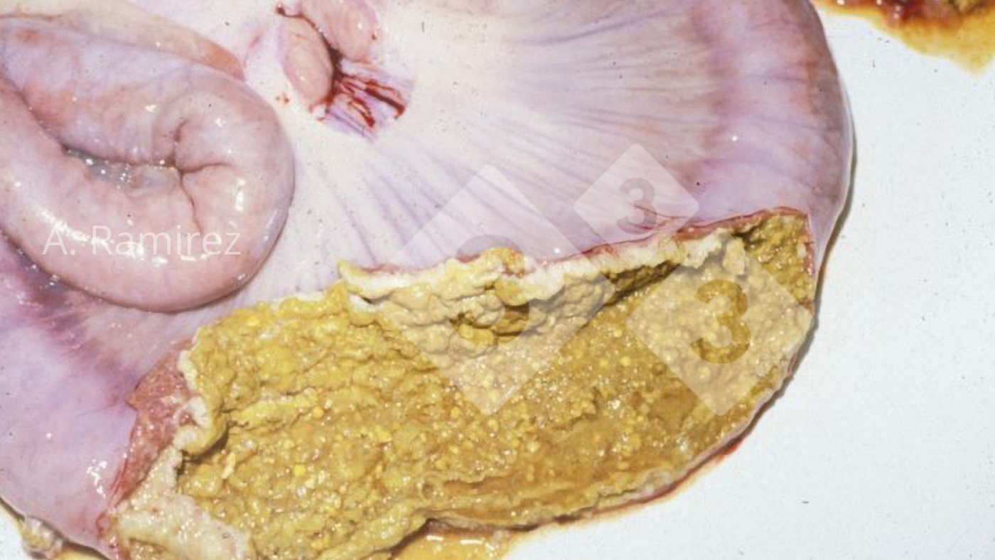 <p>Imagen&nbsp;3. &Iacute;leon de cerdo con una membrana necr&oacute;tica adherida a la superficie de la mucosa intestinal.</p>
