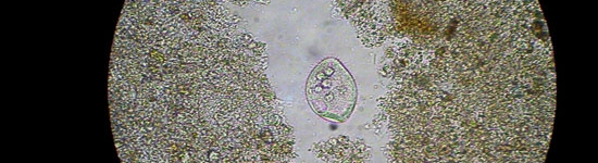 Trofozoíto de Balantidium coli