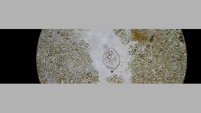 Trofozoíto de Balantidium coli