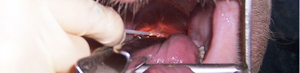 Laryngeal swab