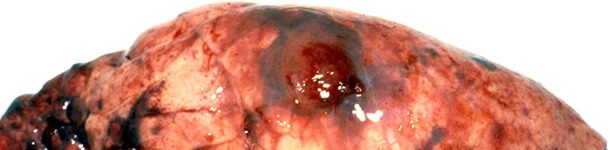 Chronic core lesion typical of Acpp &ndash; the haemorrhagic and necrotic lung lesion is overlain with pleural tags
