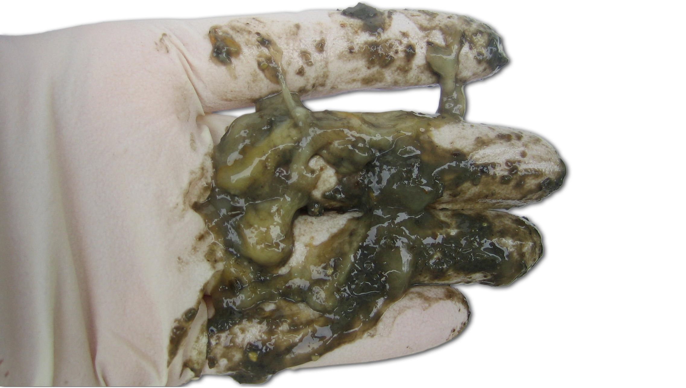Catarrhal diarrhea
