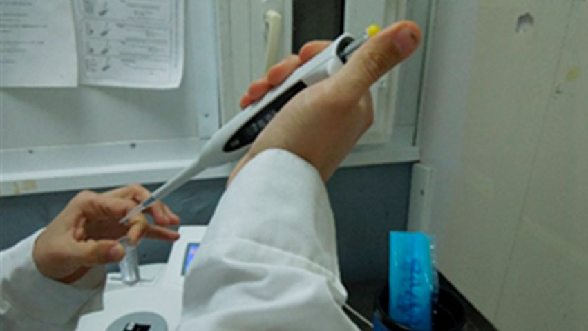 Semen evaluation
