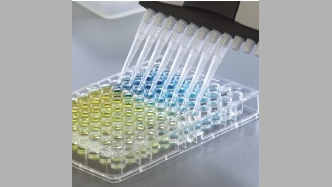 Serology testing.