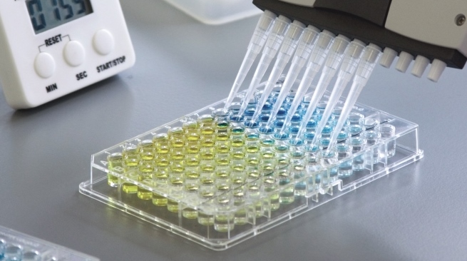 Serology testing.