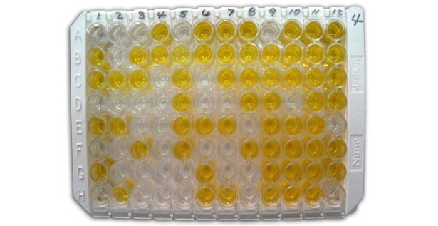 Figure 1: Indirect ELISA for detection of anti-Chlamydia antibodies in serum.
