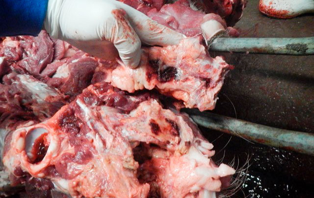 Hematomas and necrosis around a fracture
