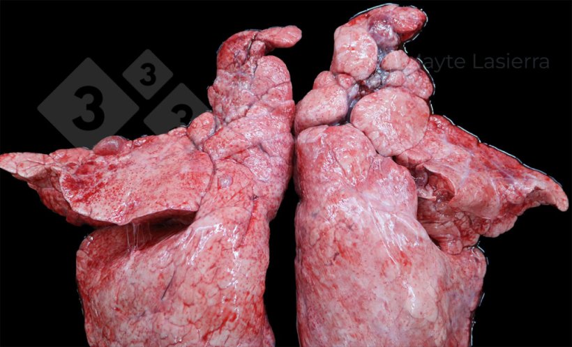 Cranial pleuritis
