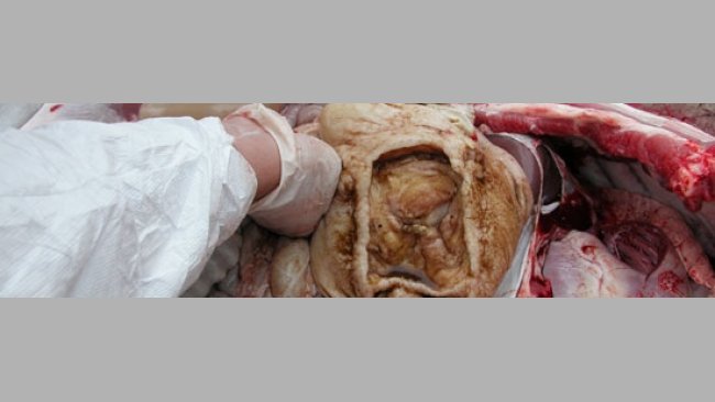 Stomach ulcers