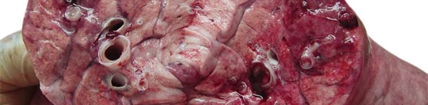 Lung cross-section