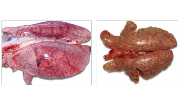 Lungs