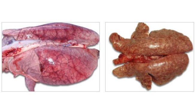 Lungs
