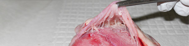 Serce, zapalenei osierdzia obserwowane w uog&oacute;lnionym zakażeniu M. hyorhinis