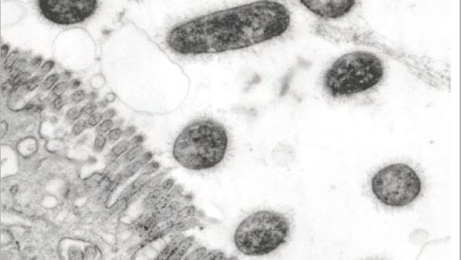 Bakterie ETEC posiadają podobne do włosów adhezyny fimbrialne na swojej powierzchni i dzięki nim przylegają do komórek nabłonkowych jelita u świń z biegunką, co wykazano w badaniach przeprowadzonych w mikroskopie elektronowym