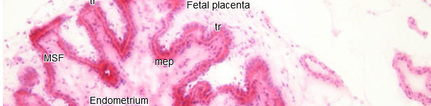 Histopathology in the endometrium and placenta