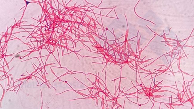 Rysunek 2. Fusobacterium necrophorum pod mikroskopem.
