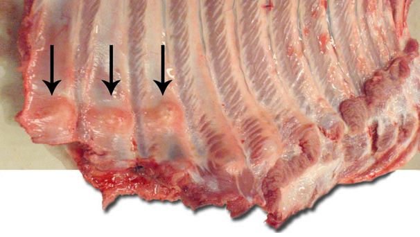 Widoczne liczne złamania żeber w częściach dystalnych, z uformowaną kostniną (strzałki).