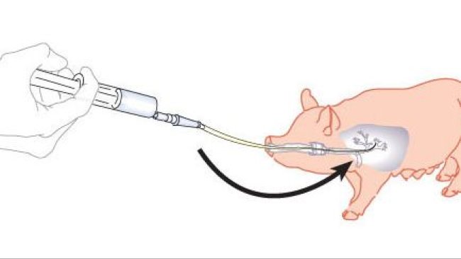 Figura 1. Esquema de lavado broncoalveolar y raspado bronquial.