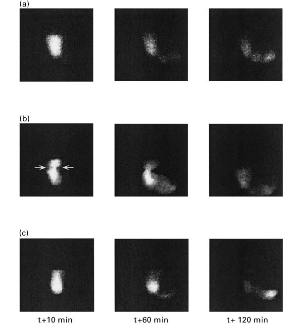 Figura 1. Imagens do esvaziamento g&aacute;strico em porcos&nbsp;alimentados com&nbsp;uma dieta baseada em&nbsp;amido (a), polpa de beterraba (b) e farelo de trigo aos&nbsp;10, 60 e 120 minutos p&oacute;s-ingest&atilde;o (Fonte: Guerin et al., 2001).
