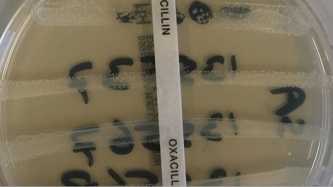 resistência antimicrobiana