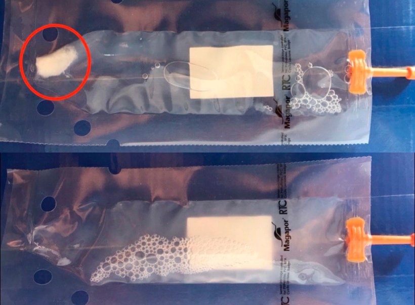 Foto 2. Na parte superior da imagem, dose com sedimentação seminal, na parte inferior, dose homogeneizada correctamente. Esta homogeneização evitará a perda de viabilidade dos espermatozóides e a melhor distribuição destes no meio.