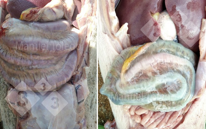 Foto 2. Edema de c&oacute;lon
