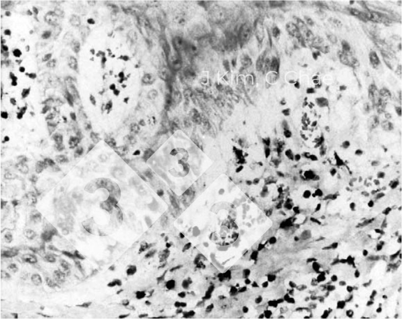 Figura 2. Presen&ccedil;a simult&acirc;nea de circov&iacute;rus su&iacute;no tipo 2 e parvov&iacute;rus su&iacute;no em casos retrospectivos. J. Kim, C.Chae- The Veterinary Journal 167 (2004) 104-106. Comunica&ccedil;&atilde;o breve
