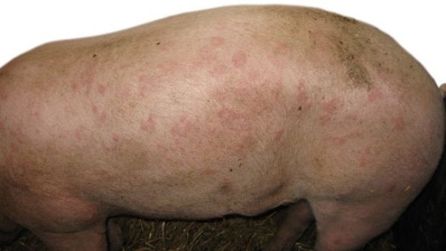 Forma cutánea o urticante de la erisipela porcina.