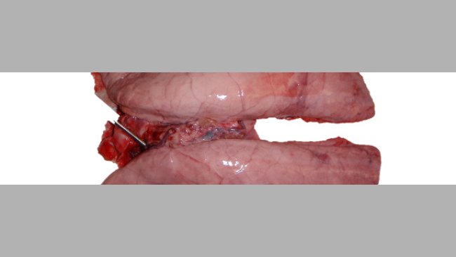 Pulmón infectado experimentalmente con Mycoplasma hyopneumoniae.