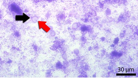 Frotis fecal te&ntilde;ido con Diff-Quick. La flecha roja se&ntilde;ala la vacuola central y la negra el n&uacute;cleo.