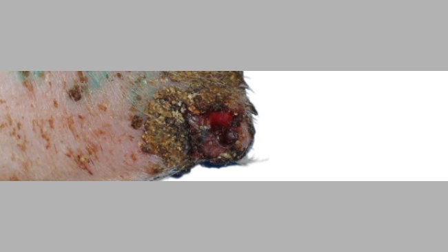 Ulceración, formación de costras y engrosamiento de la epidermis