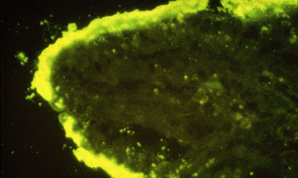 Плотные колонии E. coli прикреплены на кишечной ворсинке (IFA).
