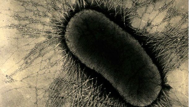 Рис. 1. Факторы прикрепления на ETEC специализированные фимбриальные протеины или жгутики (pilus),они твердо прикрепляются к рецепторам гликопротеида энтероцита на кишечных клетках.
