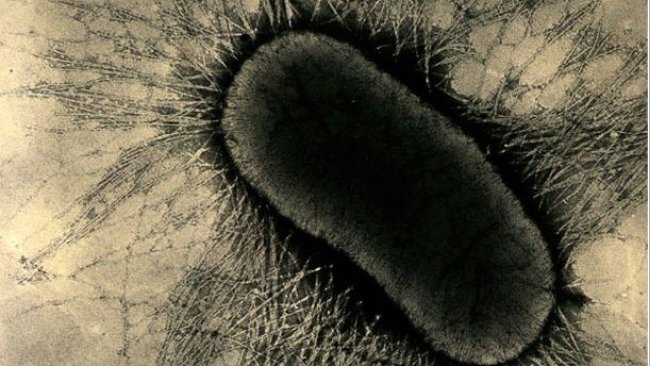 Рис. 1. Факторы прикрепления на ETEC специализированные фимбриальные протеины или жгутики (pilus),они твердо прикрепляются к рецепторам гликопротеида энтероцита на кишечных клетках.