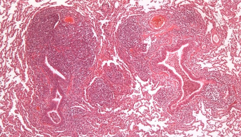 Фото 2: Гиперплазия перибронхиалярной лимфоидной ткани, вызванной M. hyopneumoniae.
