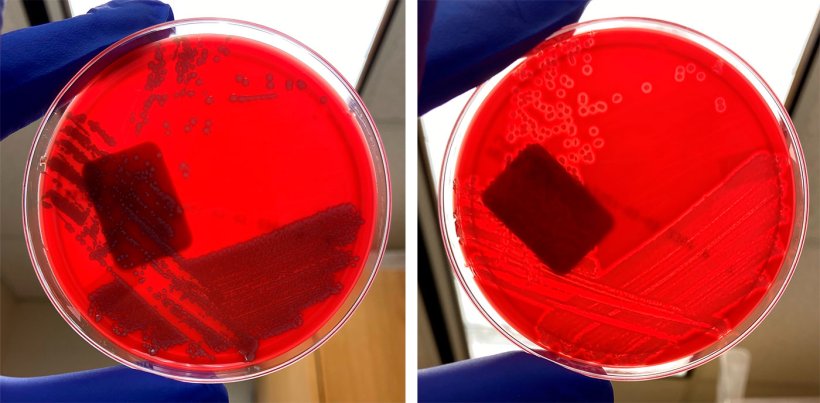 Негемолитический E coli (слева) и гемолитический E coli (справа).
