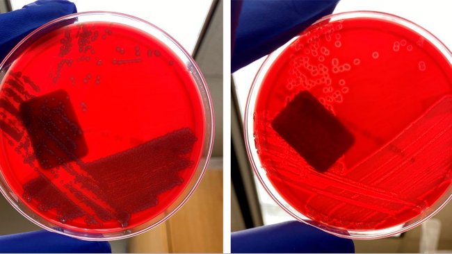 E. coli không tan huyết (trái) và E. coli tan huyết (phải).