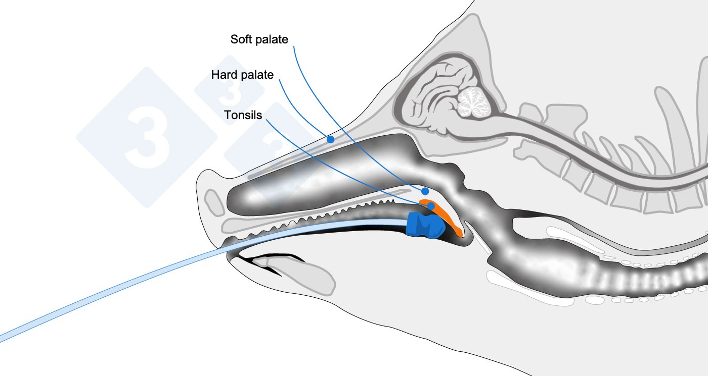 Anatomical diagram indicating the sampling area