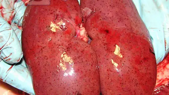 Semaine du 11-Mar-2026