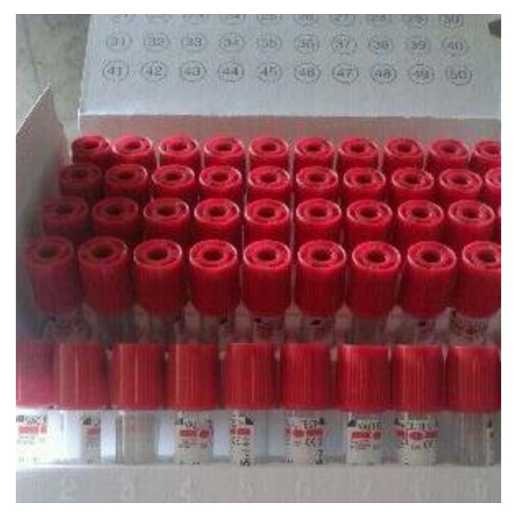 Vacutest-buise 4.5 ml - 50 eenhede
