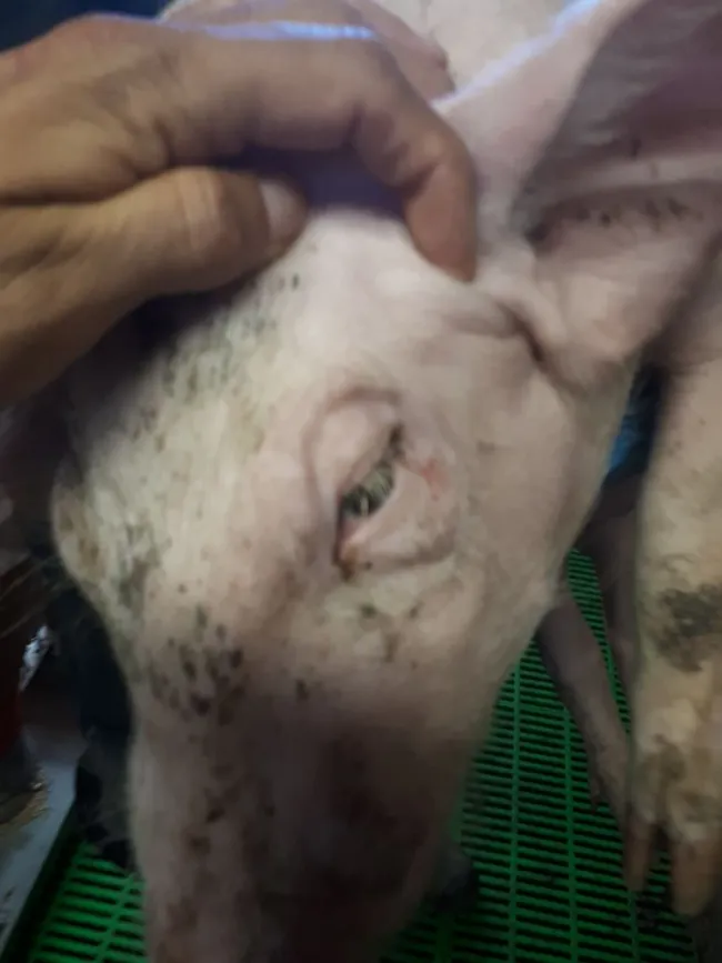 Enfermedad de los edemas: