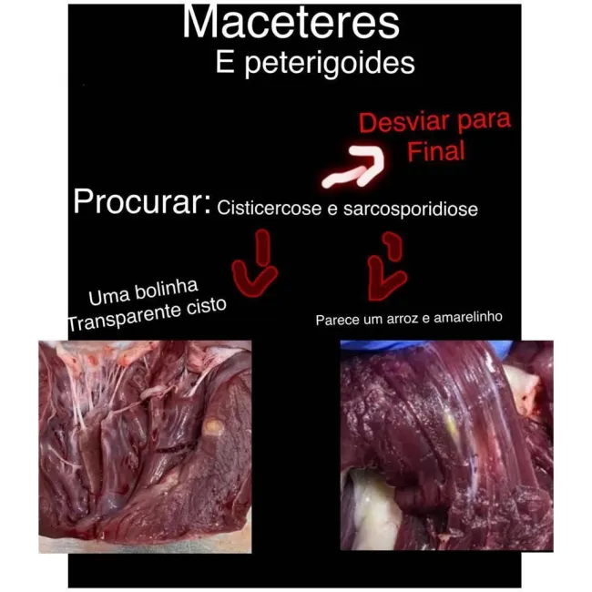 masseteres peterigoides
