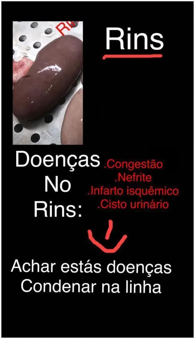 infarto isquêmico, nefrite, cisto urinario, congestão 