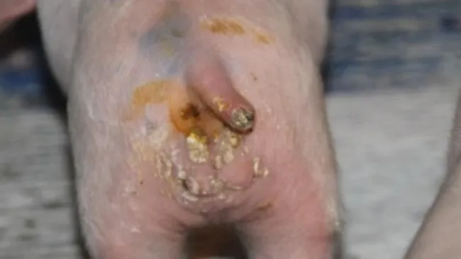 Case Study: Utilizing Probiotics as a therapeutic approach for treating diarrhea in nursery piglets.