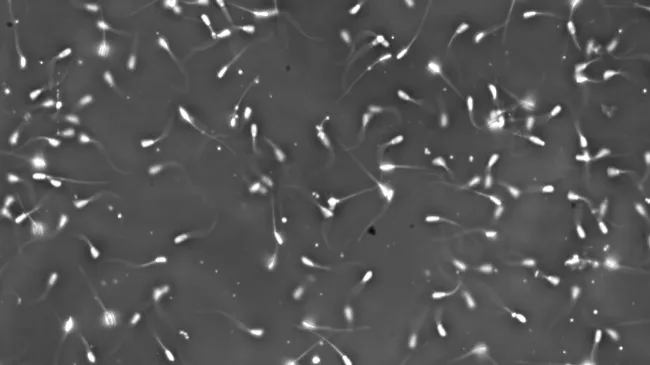 ¿Por qué a veces el número de espermatozoides por dosis puede variar?