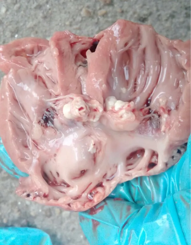Endocarditis ( streptococcus??...) !