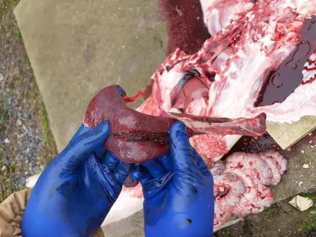 Spleen rupture.