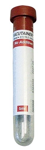 Vacutainer: tubos 5 ml 40 unidades (2) Vacutainer: tubos 5 ml 40 unidades (2)